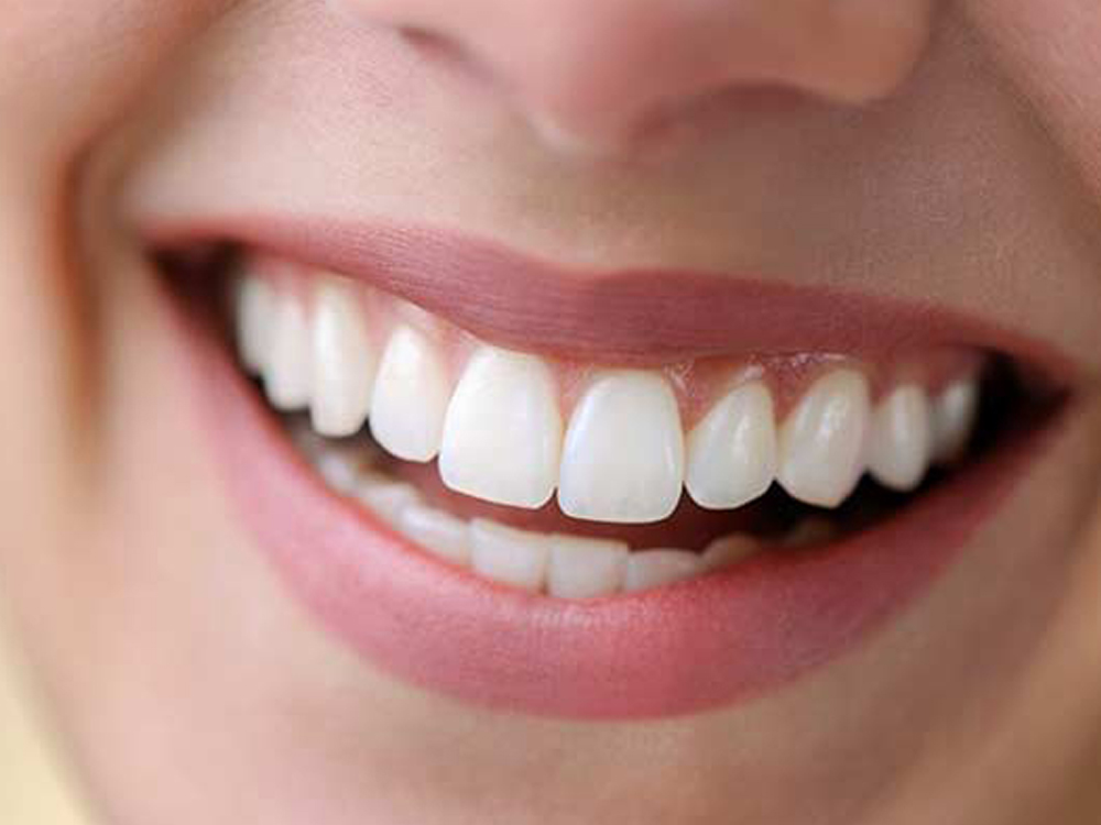 Zirkonyum Diş Kaplama 2 svg+xml;charset=utf