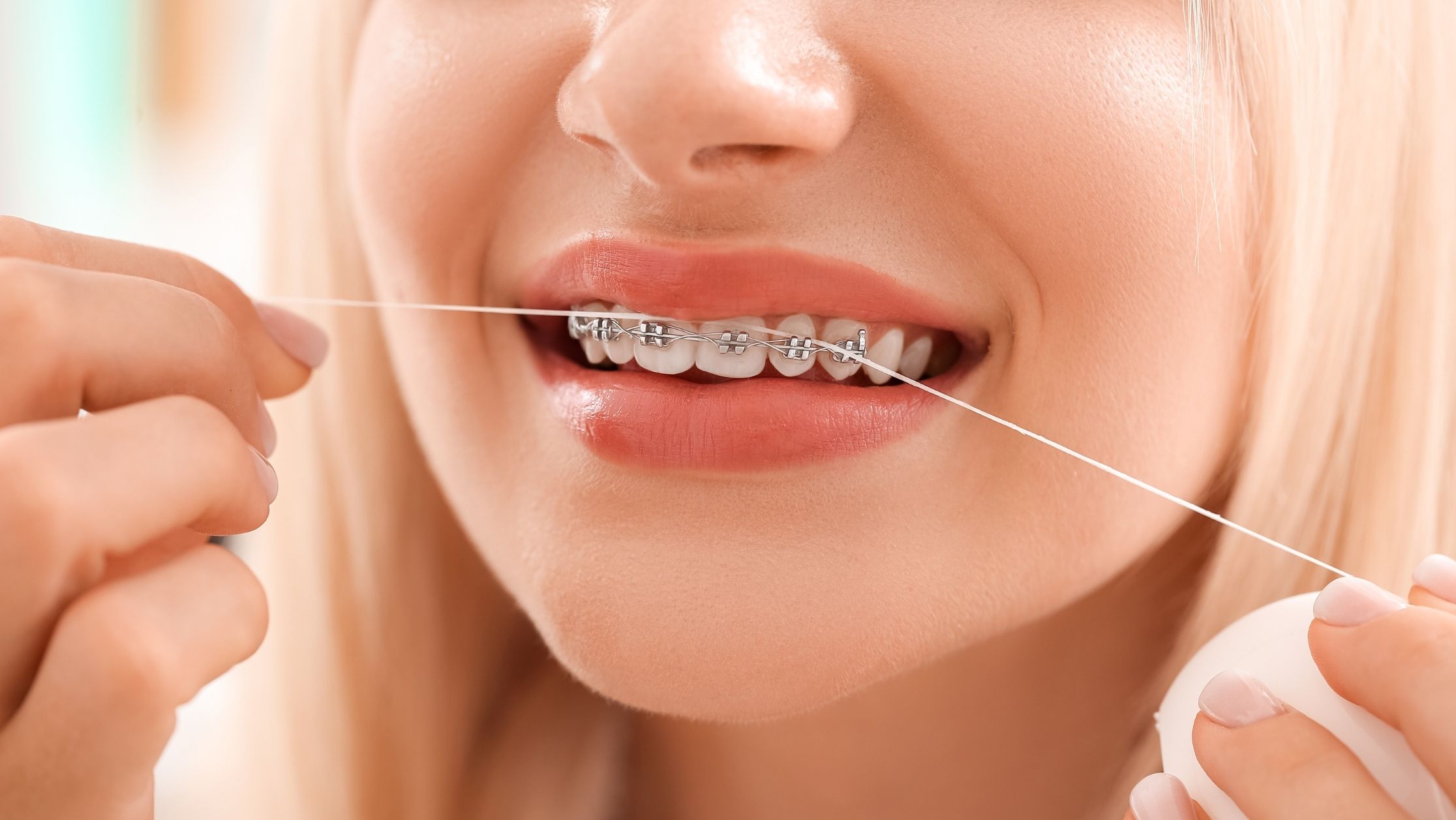 Ortodonti / Şeffaf Ortodonti 4 svg+xml;charset=utf