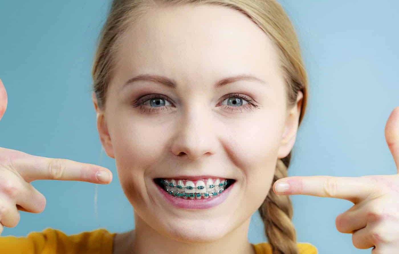 Ortodonti / Şeffaf Ortodonti 5 svg+xml;charset=utf