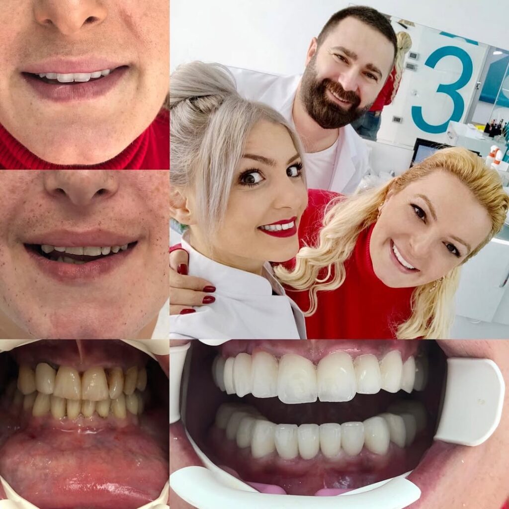 DENT32 BEFORE AFTER (3) svg+xml;charset=utf