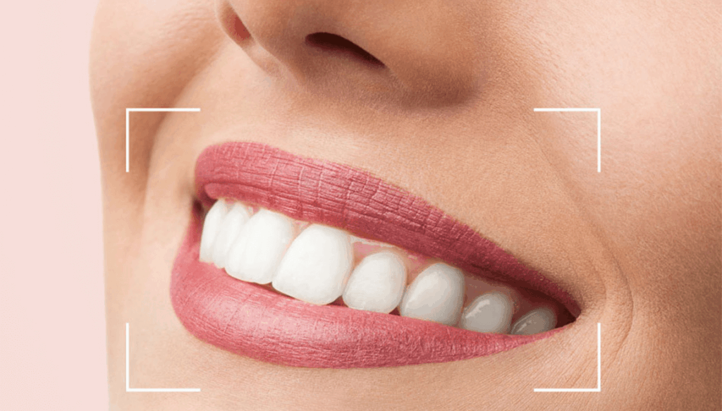 Beylikdüzü Dent32 Kliniği’nde Dijital Gülüş Tasarımı ve Hollywood Smile: Hayalinizdeki Gülüşe Kavuşun