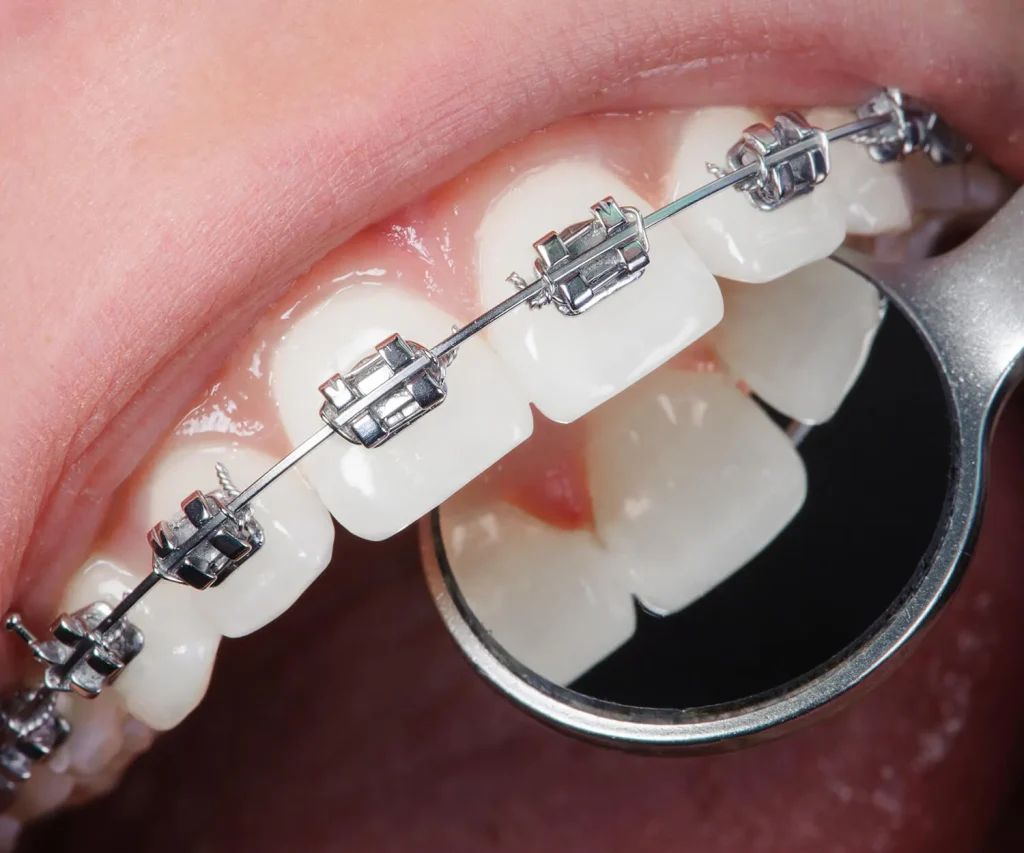 Anasayfa 34 svg+xml;charset=utf